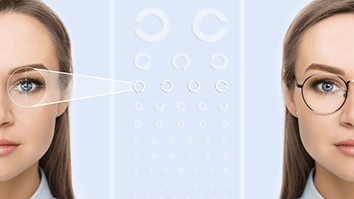 Vision Correction