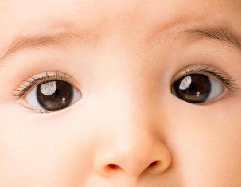 baby eye for Retinopathy of prematurity