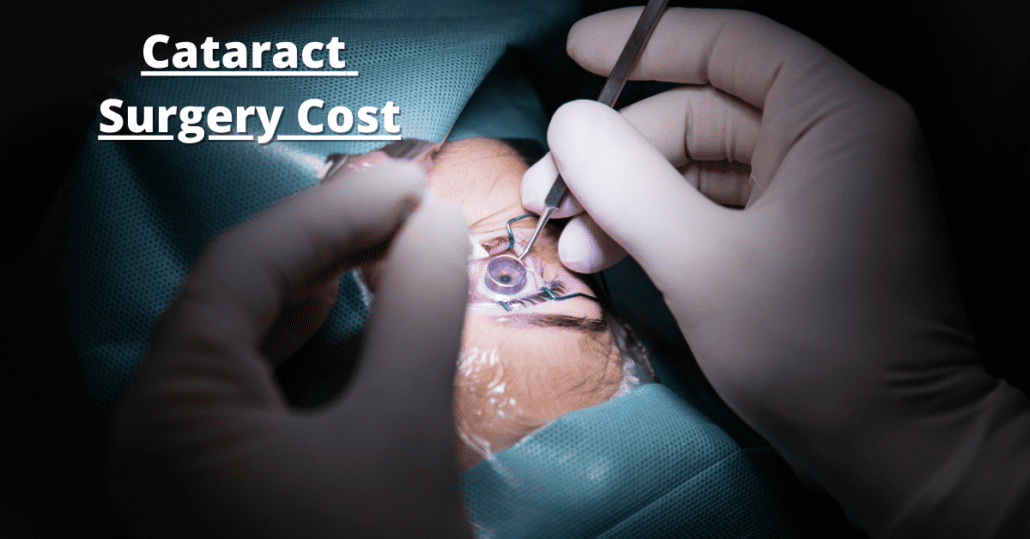 Cataract Surgery Cost in Gurgaon What You Need to Know