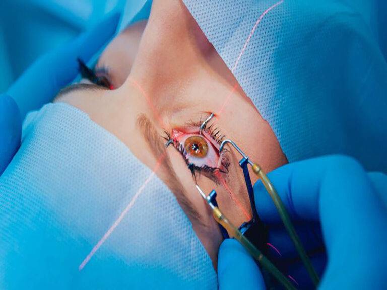 Experience the SILK Procedure: Next-Gen Vision Correction | Eye-Q Eye ...
