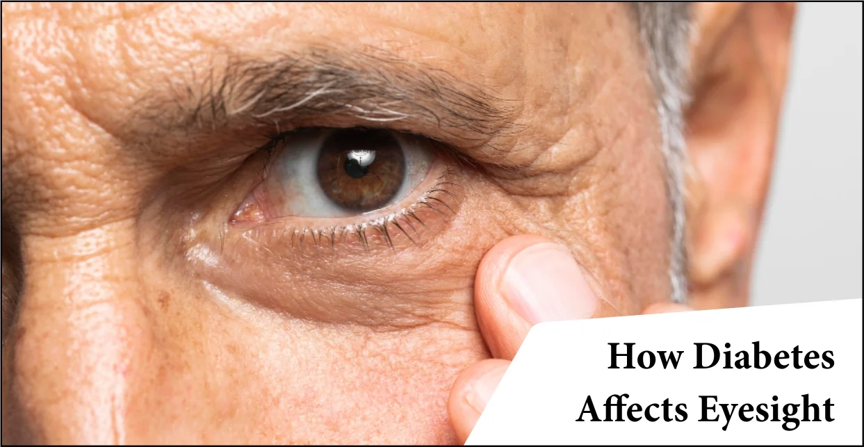 how-diabetes-affects-eyesight