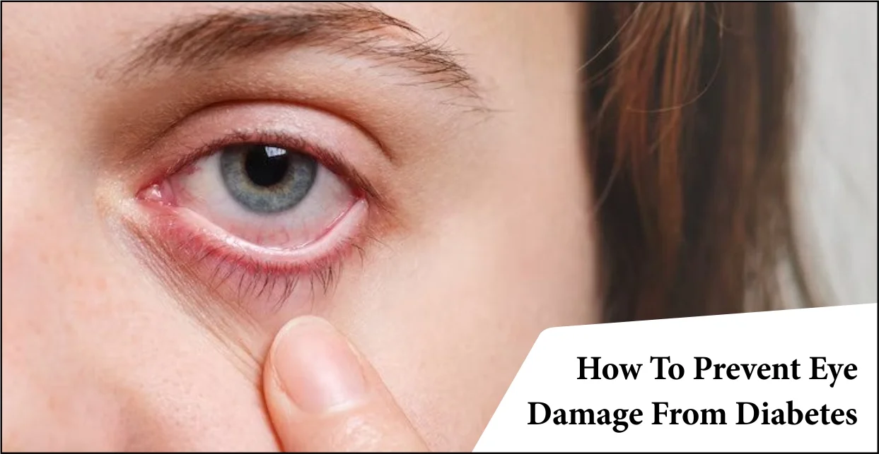 how-to-prevent-eye-damage-from-diabetes-top-10-steps