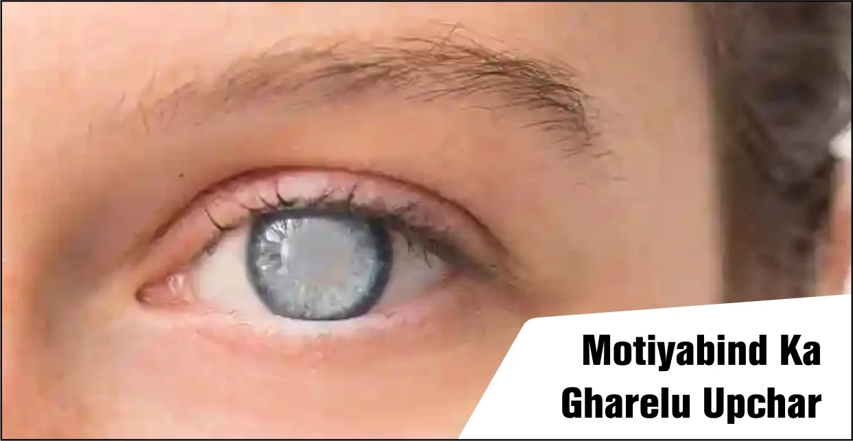 motiyabind-ka-gharelu-upchar