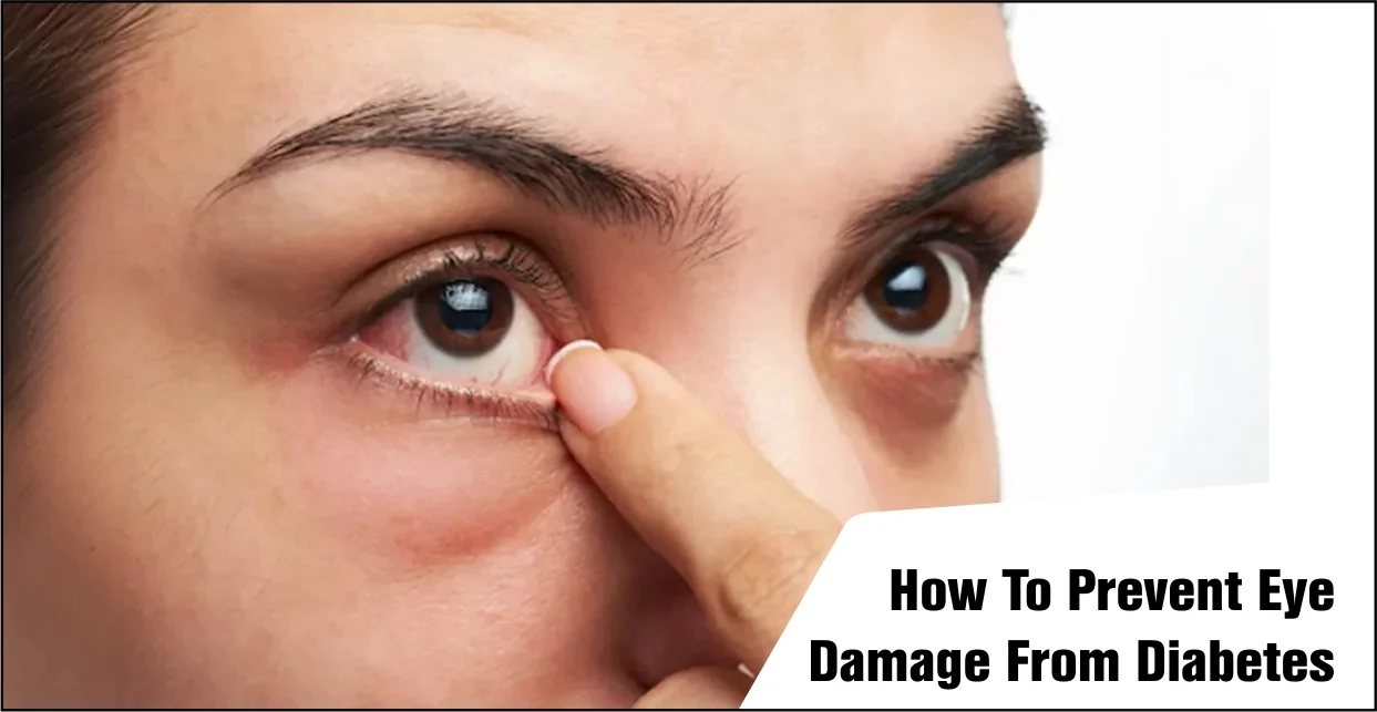 How To Prevent Eye Damage From Diabetes