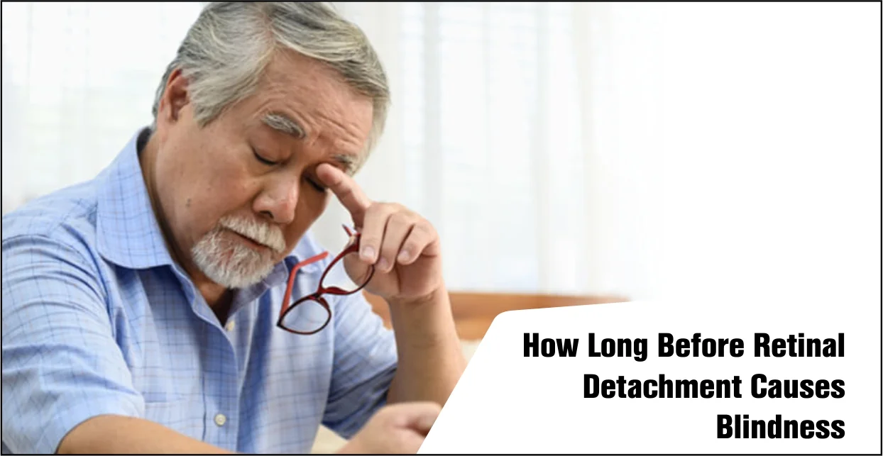 How Long Before Retinal Detachment Causes Blindness