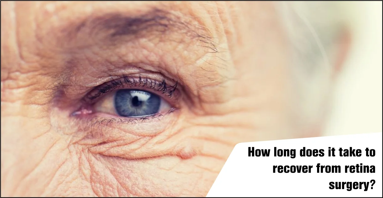 How Long Does It Take to Recover from Retina Surgery?