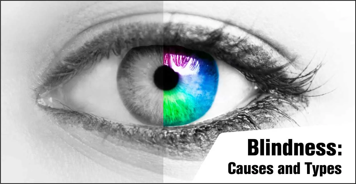causes of blindness