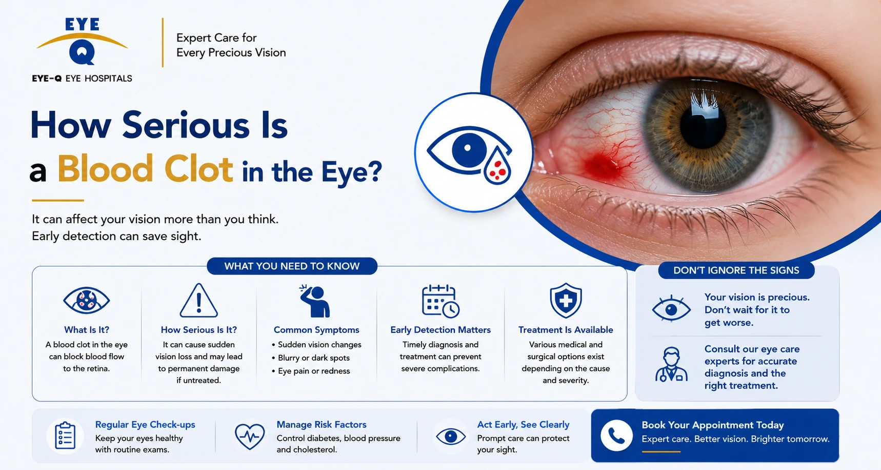 How Serious Is a Blood Clot in the Eye