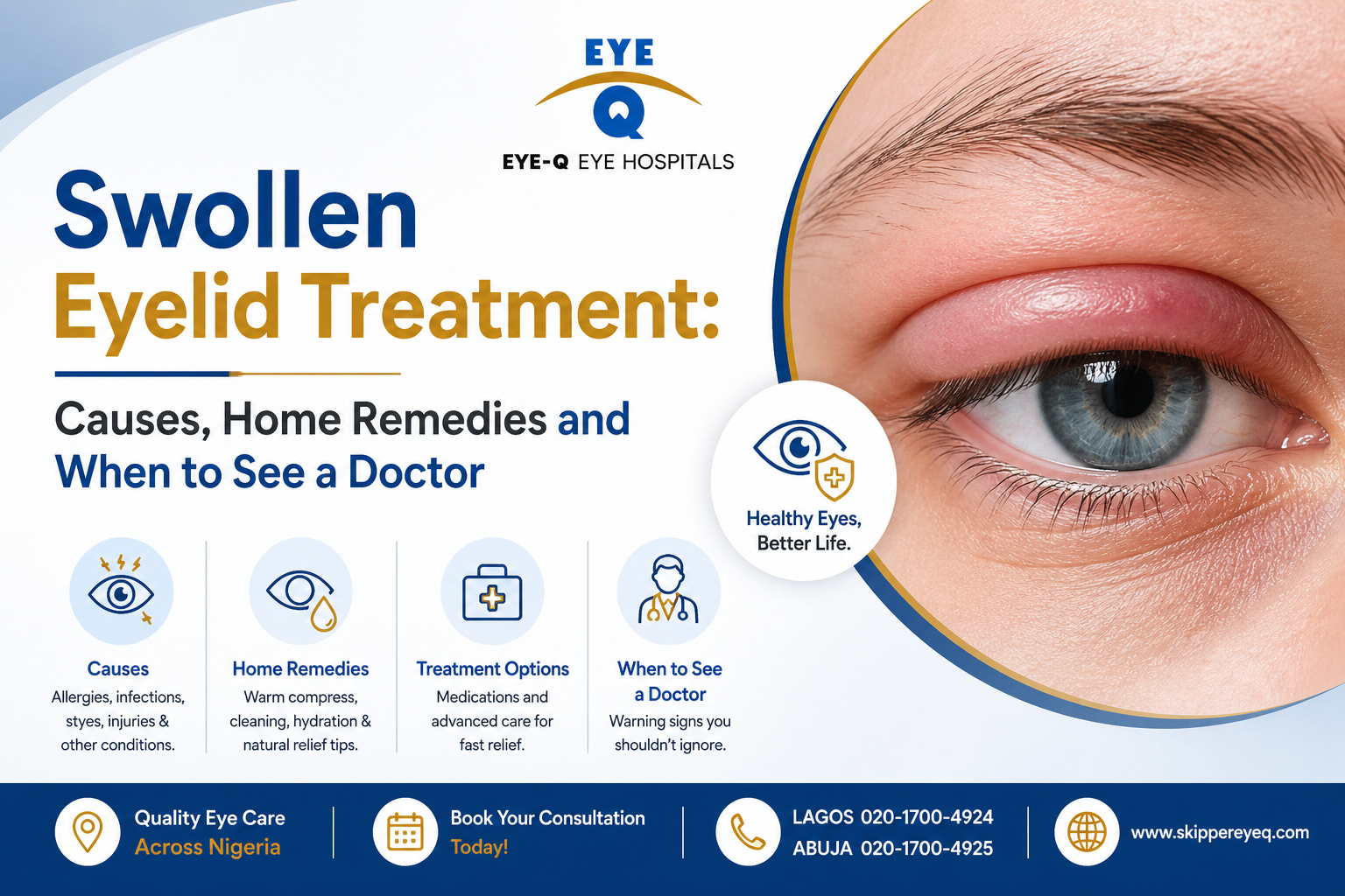 Swollen Eyelid Treatment