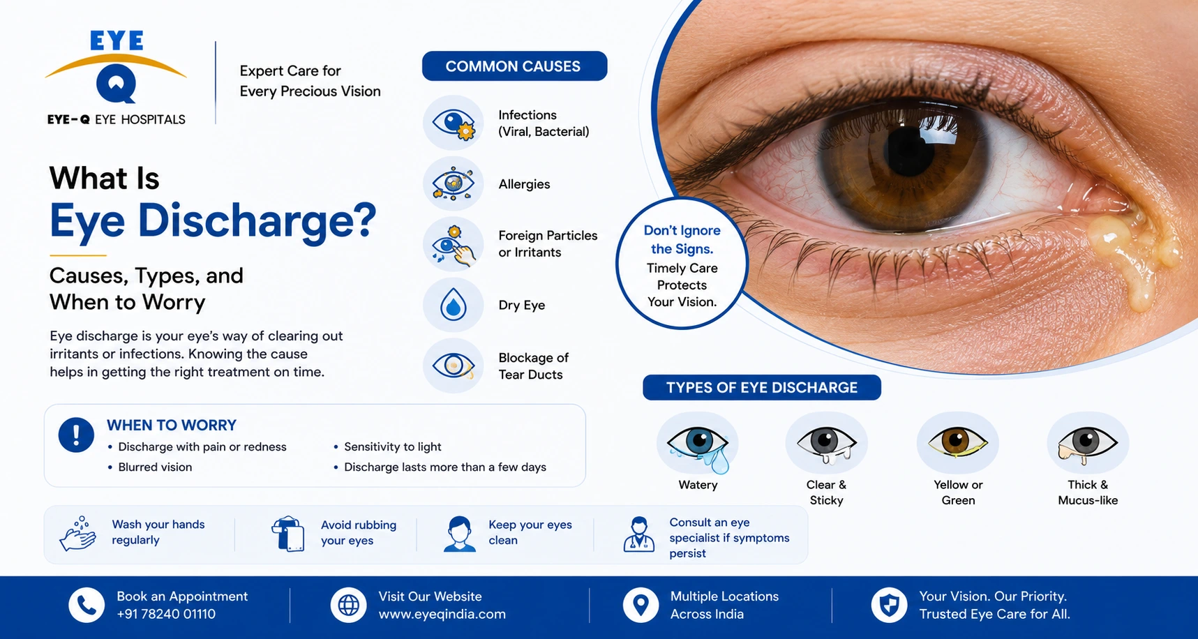 What Is Eye Discharge Causes, Types, and When to Worry