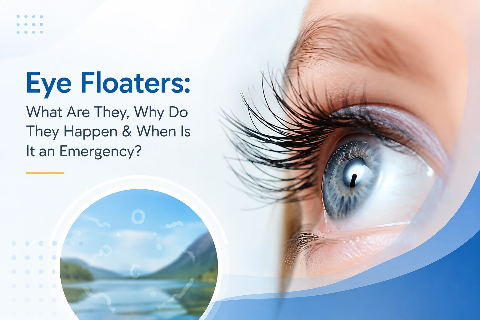 Eye Floaters